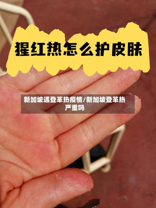 新加坡遇登革热疫情/新加坡登革热严重吗