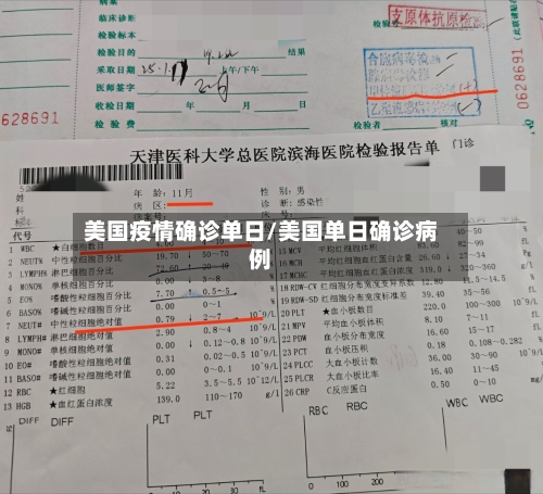 美国疫情确诊单日/美国单日确诊病例-第3张图片